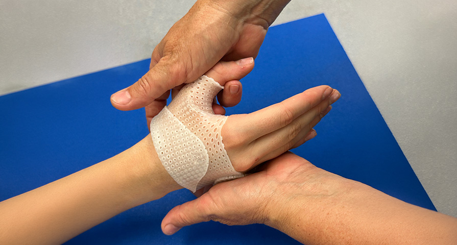Nahaufnahme der Behandlung einer Hand in der Physiotherapie/Ergotherapie am Kantonsspital Schaffhausen